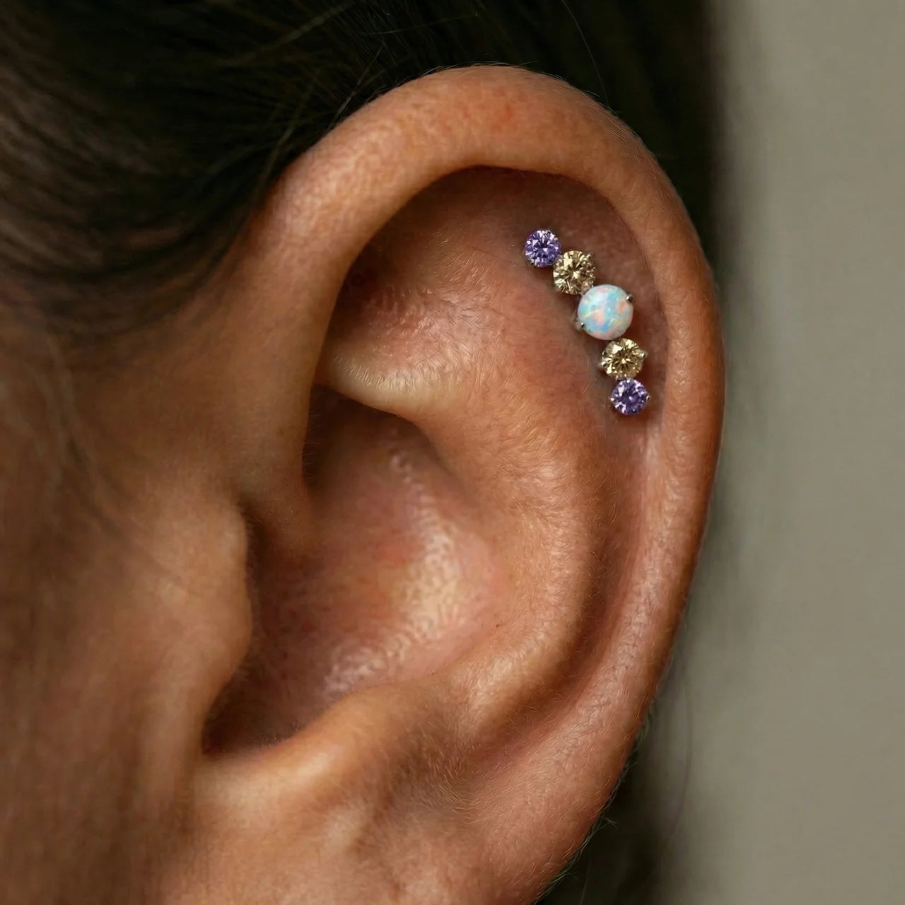 Topo Curva Opala e Zircónias