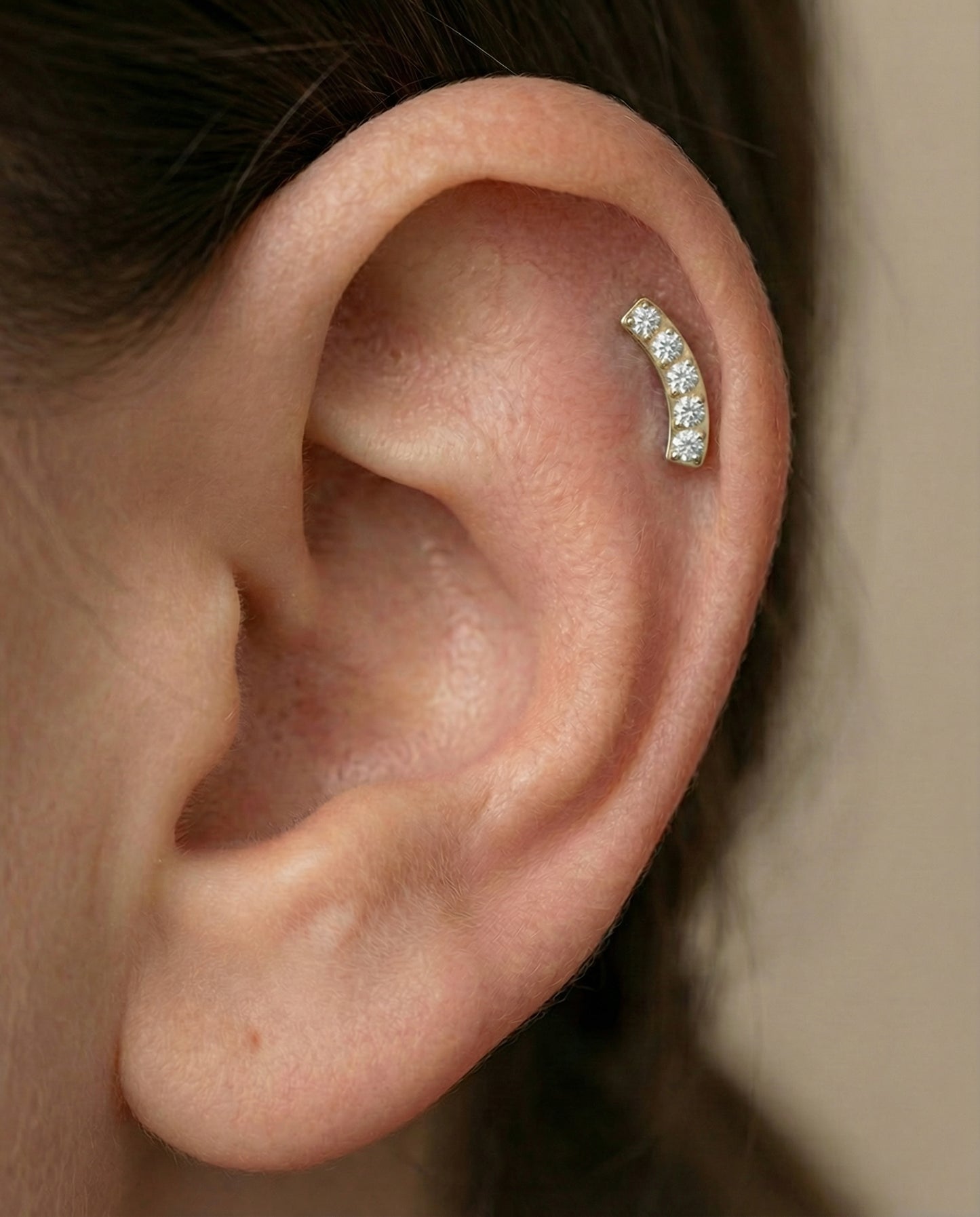 Topo Zircónias Moldura Curva - Rosca Interna Titânio PVD GOLD