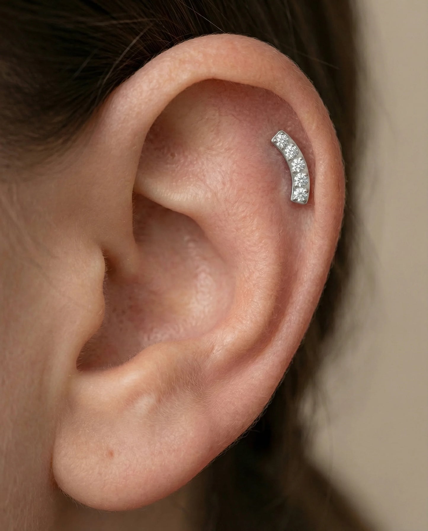 Topo Zircónias Moldura Curva zirconias brancas