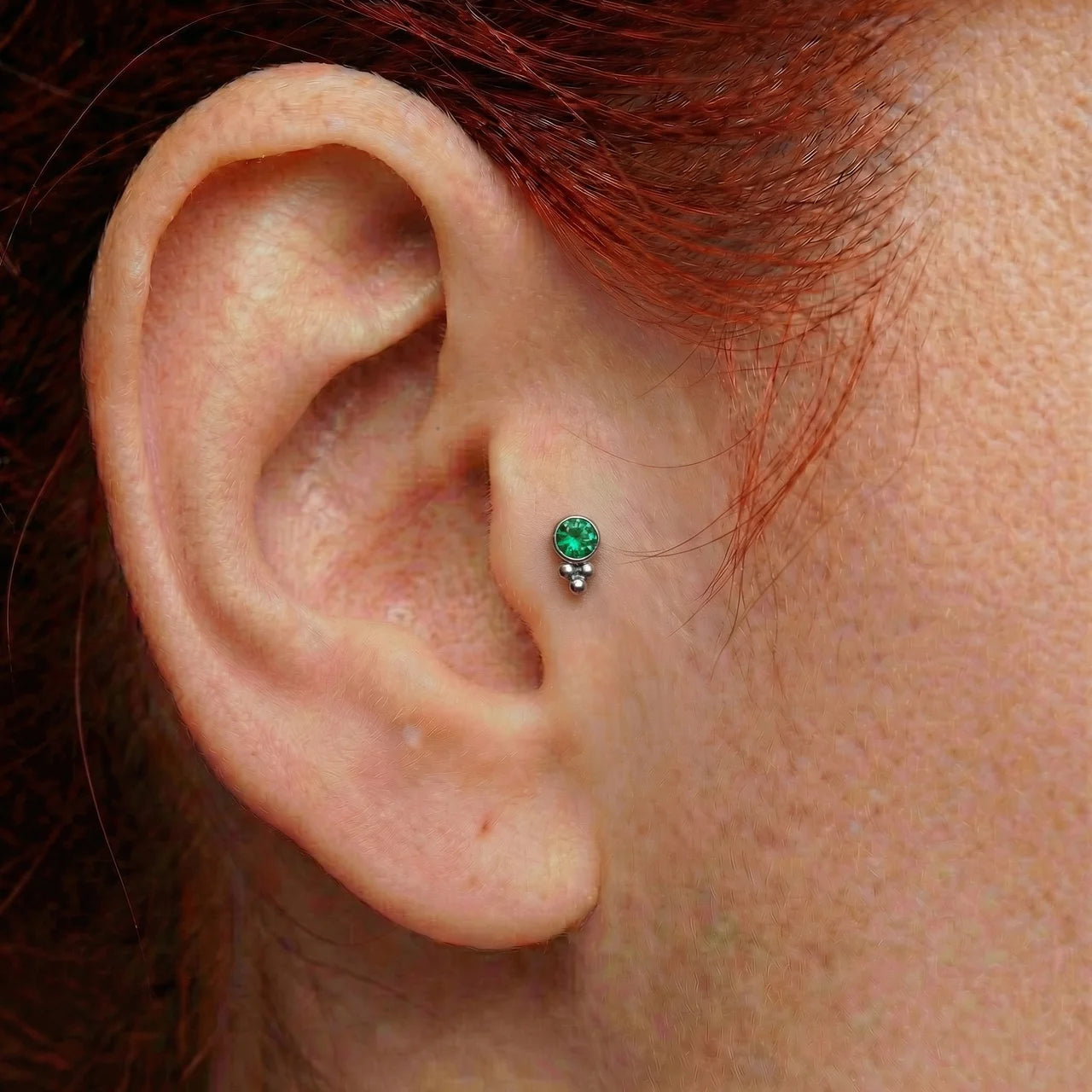 
                  
                    Topo Zircónia c/ Trinity
                  
                