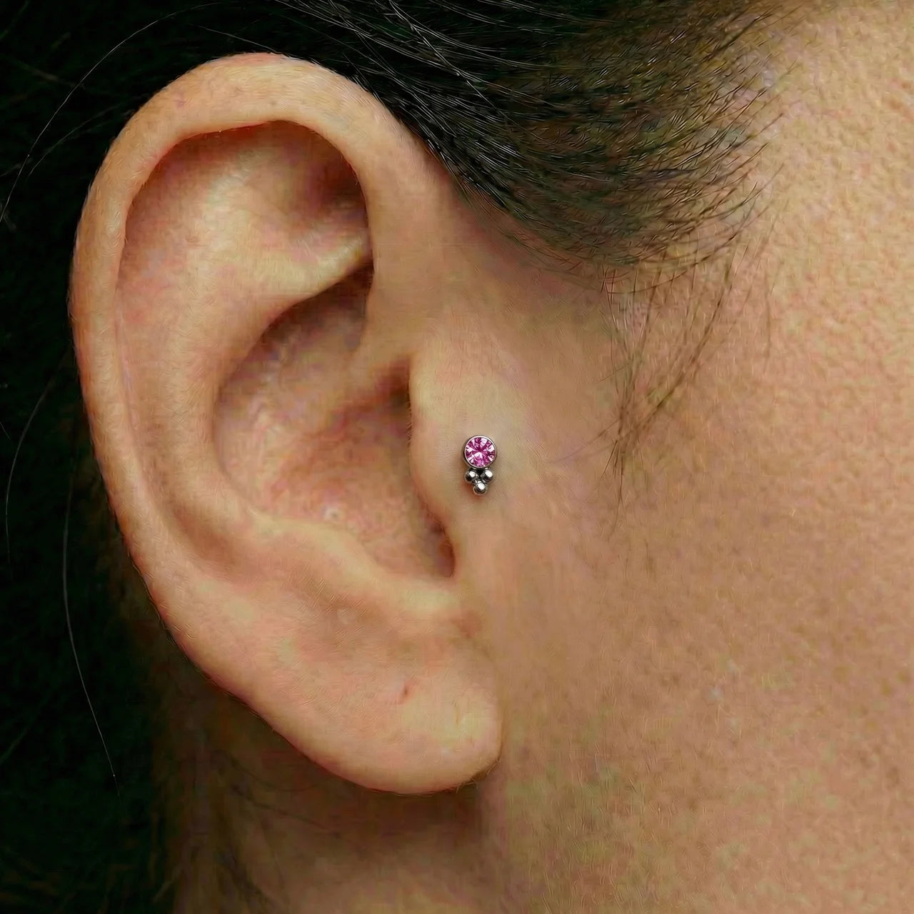 
                  
                    Topo Zircónia c/ Trinity
                  
                